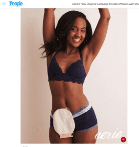 Model Who Beat Cancer Poses with Ostomy Bags to Inspire Survivors