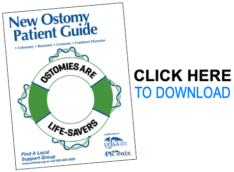 A Guide to Ostomy Bag Care - UChicago Medicine