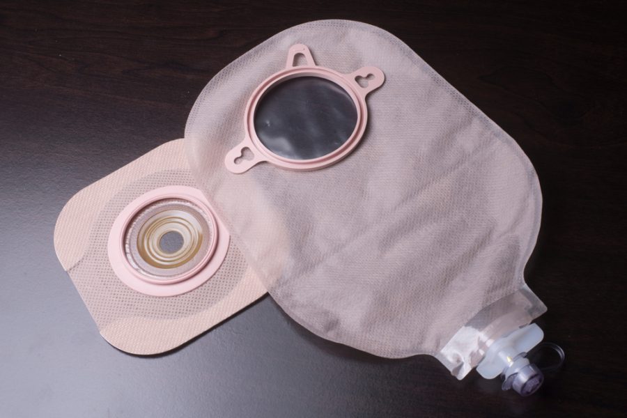 A Quick Guide to Urostomy Basics - United Ostomy Associations of America